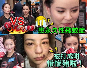  港姐真人秀被打成猪头退出港姐圈昔日港姐今何在