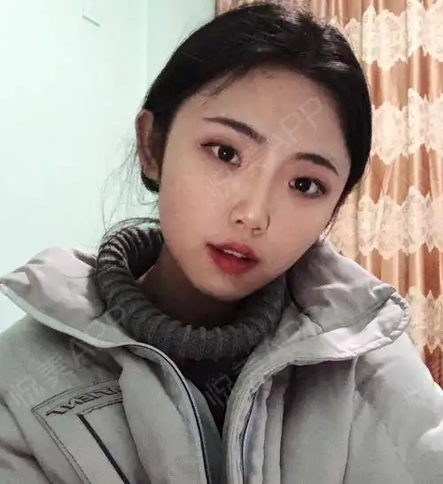  宝宝们昨天情人节是怎么过的呢有没有携带男友一起过...垫鼻尖悦美整形