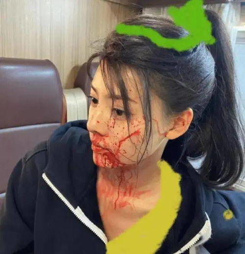  黄景瑜前妻王雨馨凌晨自杀,两人已离婚两年,迪丽热巴新剧被影响