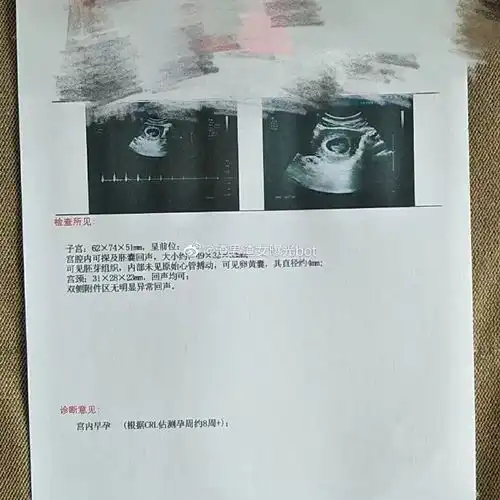  男朋友换上了情侣头像,和其他妹子光明正大秀恩爱还把我拉黑了