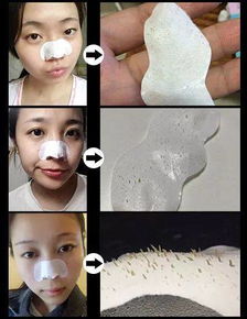  90的女生都毁在这你脸上黑头真脏,怎么化妆都白费