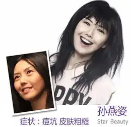  汤唯落泪眼角露细纹出招攻破明星肌肤窘态